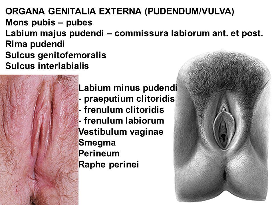 Que pasa si se revienta una hemorroide externa